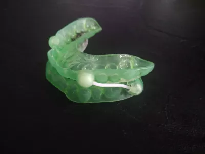 Cleaning An Oral Sleep Apnea Apparatus: How-To? : Cleaned mandibular advancement splint after a brush, a dental tab bath, and a mouthwash bath